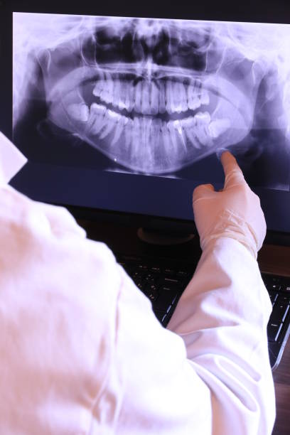 Best Emergency Root Canal Treatment in Potomac Mills, VA